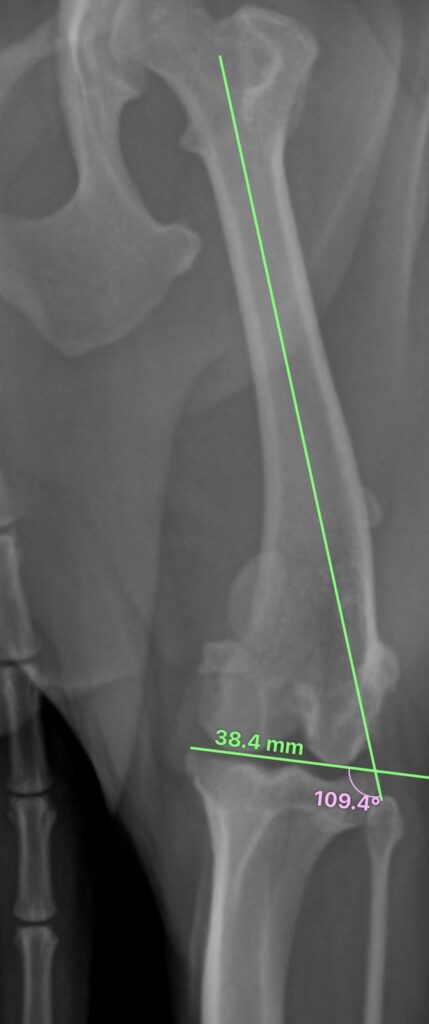 calculo-de-angulação-da-osteotomia-do-femur-da-cirurgia-de-luxacao-de-patela